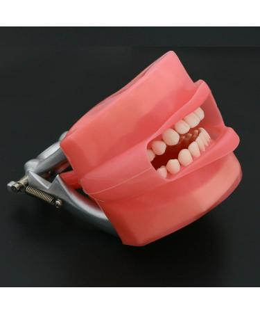 Dental Teeth Model Adult Denture Model with 28/32 Teeth Detachable Teeth Teeth Model Suitable for Research and Teaching for Dental Students Patient Education Display (M8012 + Simulation Cheek) - Buy Online on GoSupps.com
