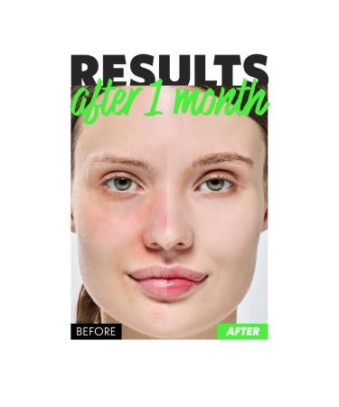 NOSCA9 Soothing Cream S - Soothing Barrier Cream with 5-Layer Ceramide Complex & Live Fresh Cica For Sensitive & Irritated Skin Korean Skincare (1.52 Fl Oz) - Buy Online on GoSupps.com