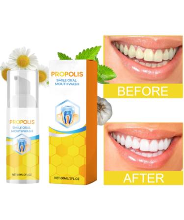 Propolis Smile Mouthwash - Total Care for Teeth & Gum Health | Refreshing Breath & Deep Cleaning (2 pcs) - Buy Online on GoSupps.com