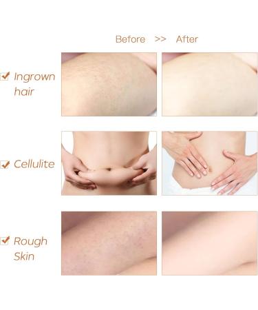 ICANdOIT High Strength Dry Body Brush - Natural Bristle Exfoliating Massage Brush for Cellulite, Lymphatic Drainage, and Soft Skin - Stiff Tampico Fiber for Improved Circulation and Ingrown Hair Prevention - Buy Online on GoSupps.com