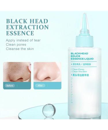 Nose Skin Cleansing Liquid Face And Nose Dirty Skin Remover Solution 150ml Refreshing Fast Absorbing Solution With 50 Cotton Pads For Mothers Ladies Women Sisters Girlfriends - Buy Online on GoSupps.com