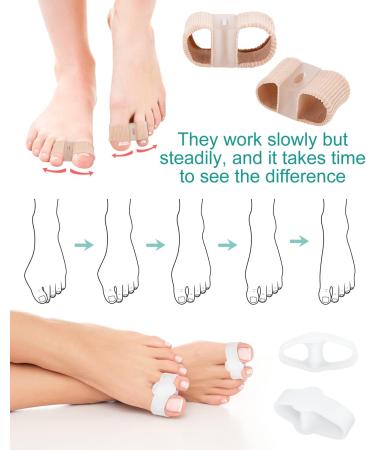 BLATOWN Toe Separators Bunion Corrector 4Pcs Set - Gel Big Toe Spacers for Feet with 2 Loops - Hammer Toe Straightener for Men and Women - Buy Online on GoSupps.com