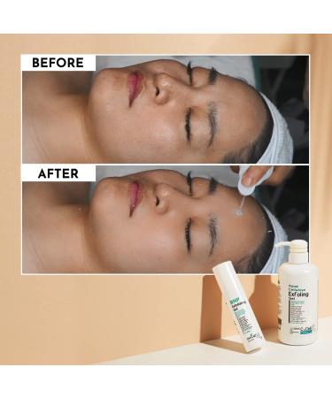 DM.Cell Gentle Aqua Facial Gommage Cleanser - Peeling Scrub Gel with Natural Extracts for Blackheads & Enlarged Pores | Paraben Free | Korean Skin Care | 3.38 fl oz - Buy Online on GoSupps.com