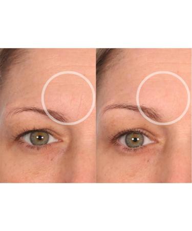 SiO Beauty BrowLift Forehead Anti-Wrinkle Patch - Rapid Overnight Reusable Silicone Patch to Reduce Furrows Expression Lines and Creases - Buy Online on GoSupps.com
