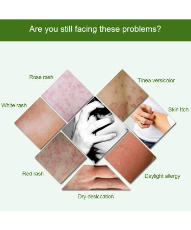 Psoriasis Herbal Body Ointment - Fast Relief for Eczema & Itching - 15g - Buy Online on GoSupps.com