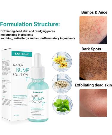 Razor Bumps Solution Skin Ingrown Hair Solution Bumps Reduce Redness Dark Spot 30ml - Buy Online on GoSupps.com