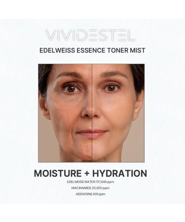 VIVIDESTEL Edelweiss Essence Toner Facial Mist - 727 645 ppm Edelweiss Flower Extract Essence Facial Toner Skin Mist - No Water & Oil Added - Edelweiss Extract and Niacinamide Facial Spray - 100ml - Buy Online on GoSupps.com