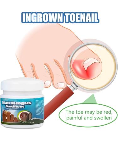 Soins des ongles de pied endog nes Cr me r paratrice pour les ongles Ongles R parateurs Renforce Les Ongles Favorise La Repousse D'ongles Sains Cr me professionnelle pour le soin des pieds(20g) - Buy Online on GoSupps.com
