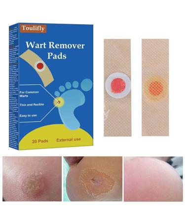 Wart Remover Corn Remover Foot Corn Remover Pads Plantar Wart Removal Corn Callus Remover Penetrates and Removes Common and Plantar Warts Callus Stops Wart Regrowth 20PC