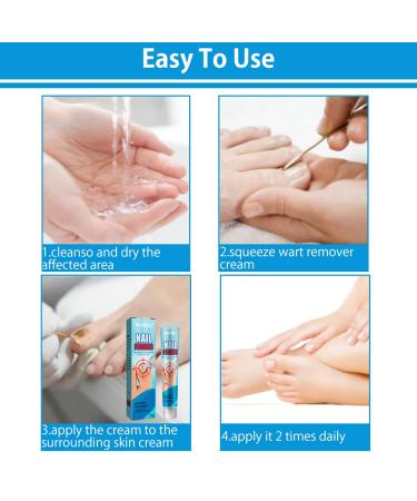 Best Nail Repair Cream for Fungus Treatment - Restores Discolored Nails - Toe & Finger Care - Buy Online on GoSupps.com
