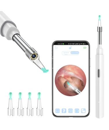 Zupora Ear Camera Ear Wax Remover Camera 1920P FHD Wireless Ear Otoscope with LED Lights Ear Camera Ear Scope with Ear Wax Cleaner Tool for iPhone iPad & Android Smart Phones (White)