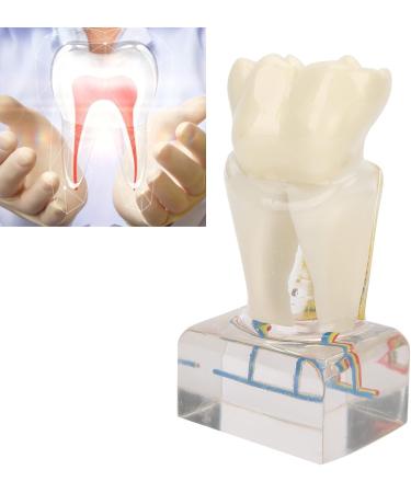 Professional Dental Nerve Model for Teaching | Resin Tooth Model for Students | International Shipping - Buy Online on GoSupps.com
