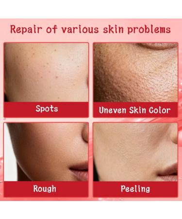 NHPY 2Pcs Cream Against Pigment SpotsPigment Spot Remover FaceFace Cream Women Age Spot RemovalDark Spot Improve Dull SkinAnti Freckles - Buy Online on GoSupps.com