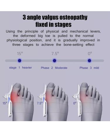 Thumb Valgus Corrector Bunion Device - Adjustable Tightness for Bunion Relief - Universal for Left and Right Feet - Buy Online on GoSupps.com