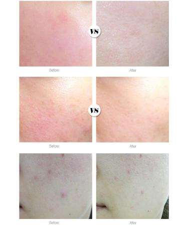  DAYCELL Machihyun 20 Calming Ampoule (Roll On) 9ml - Buy Online on GoSupps.com