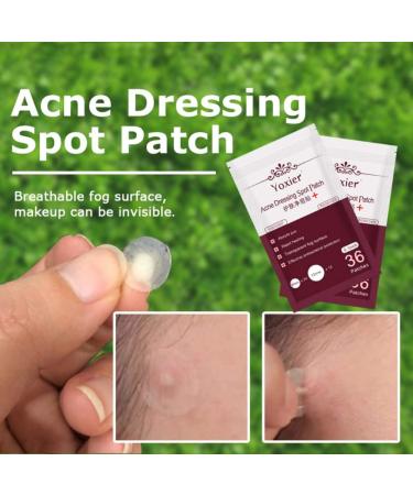 Acne Dressing Spot Patch Acne Paste Transparent Pimple Patch Breathable Painless Acne Treatment Gel Patch Skin Care Absorb Pus Rapid Healing Effective Antibacterial Protection 36 Patches - Buy Online on GoSupps.com