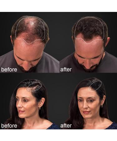 Refill Fiber for Thinning Hair - Natural Hair Building Fibers for Men & Women (Black) - Instantly Thicker Hair in 30 Sec - 100g - Buy Online on GoSupps.com