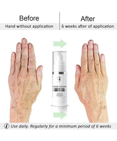 Eylleaf Anti-Pigmentation Hand Cream - Age Spot Remover for Mature Skin or Discoloration Symptoms 30ml - Buy Online on GoSupps.com