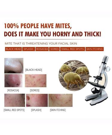 BIOAQUA Acne Scar Gel - Natural Blemish & Pimple Removal Cream for Oil Control & Pore Shrinking | International Shipping - Buy Online on GoSupps.com