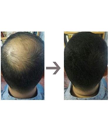 Well4u Micro Hair Fibers 50g Auburn | Hair Thinning Solutions | Bulk Hair Powder & Sealing - Buy Online on GoSupps.com