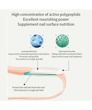 Cuticle Oil for Nails 7.5ml Nail Oil Nail Cuticle Oil with Jojoba Oil & Lavender Extract Nails Oil for Damage Nails Moisturizes Strengthen Nail Growth & Nail Repair Prevents Hangnails Cracked - Buy Online on GoSupps.com