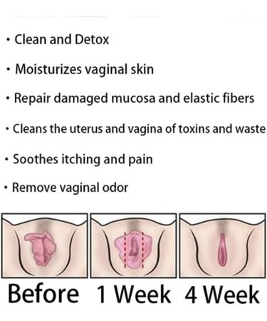 3Bag Natural Repair Vaginal Capsules - Firming & Tender Pink Capsules for Intimate Care - Stay Fresh & Clear - Buy Online on GoSupps.com