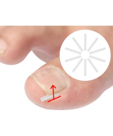 BEALIFE Curved Toenail Corrector Strips for Ingrown Toenails Effective Foot Care Solution - Buy Online on GoSupps.com