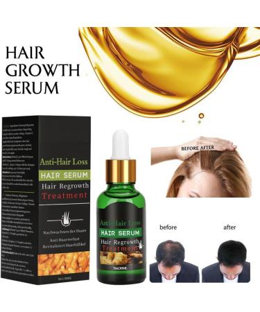 Dermaroller Set de micro-aiguilles professionnelles en titane avec 1 jeu de s rum de croissance des cheveux anti-chute de cheveux 1 jeu d'aiguilles professionnelles en titane de 0 5 mm 30 ml (Lot de 1) - Buy Online on GoSupps.com