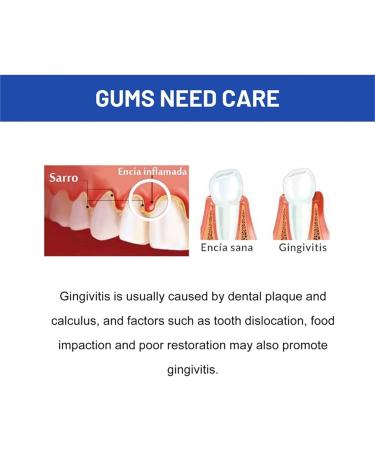 Teeth Whitening Pen - Pain-Free Dental Repair Gel for Gentle & Effective Stain Removal | White Teeth Solution (1PC) - Buy Online on GoSupps.com