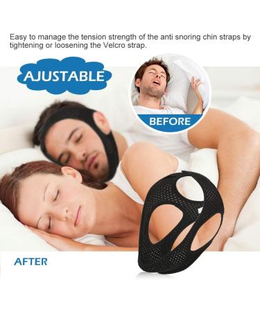 Anti Snoring Chin Strap - Adjustable, Comfortable, Professional Stop Snoring Device for Men, Women, and Kids - Black 1pc - Buy Online on GoSupps.com