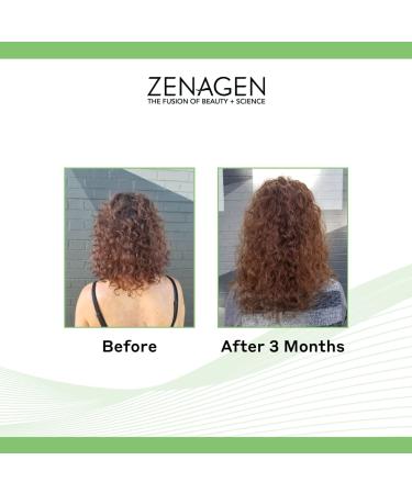 Zenagen Evolve Professional Accelerating Shampoo Treatment 6 fl oz - Hair Growth Formula - Buy Online on GoSupps.com