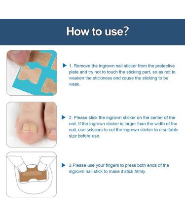 60 Pcs Toenail Correction Patch | Ingrown Toenail Treatment & Repair Stickers | Pain Relief & Easy Application - Buy Online on GoSupps.com