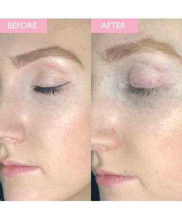 SKINICIAN Soothing Eye Makeup Remover | Gentle Face Cleanser with Vitamin E - Vegan & Cruelty-Free | 100ml - Buy Online on GoSupps.com