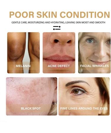 rongweiwang Women Face Wrinkle Remover Serum Moisturizing Whitening Brightening Essence Skin Care Beauty Supplies - Buy Online on GoSupps.com