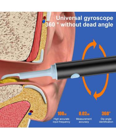 Rorodoto XIMGirl Ear Wax Removal Tool with Camera - 1080p Wireless Ear Cleaner & Silicone Spoon for iPad & Android - Safe & Effective Ear Wax Removal for Adults (Black) - Buy Online on GoSupps.com