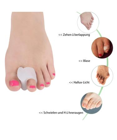 Toe Spreader for Correcting Overlapping Toes - 12 Large-Scale Toe Separator Spacers for Hallux Valgus Hammer Toes & Bunion Relief - Buy Online on GoSupps.com