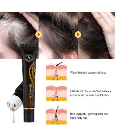 Hocossy Regrowth Organic Hair Serum Roller Set - Scalp Intense Hair Growth Treatment for Men & Women 20ml 3PCs - Natural Hair Care Solution - Buy Online on GoSupps.com