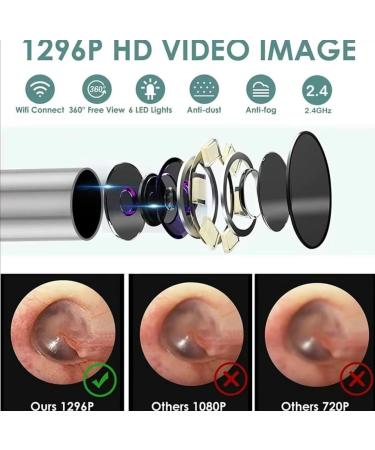 Bundle: The Ear Doctor 8 piece Earwax removal kit + Earwax removal drops (2 items) 3.6mm 1296p HD Wireless Pocket LED Camera Waterproof Ear Camera IOS&Android. Olive oil and tea tree oil drops - Buy Online on GoSupps.com