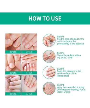 Nail Fungus Removal Liquid - Natural Toenail Fungus Oil for Effective Nail Care | BTSEURY - Buy Online on GoSupps.com