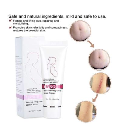 Stretch Mark Cream for Pregnancy & Scars - Maternity Repair & Acne Treatment - Buy Online on GoSupps.com