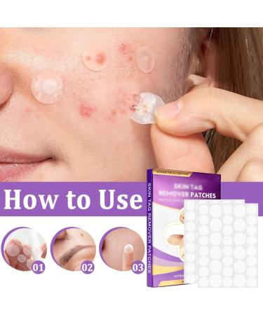 144 Pi ces Acrochordons Traitement Efficace Set Taches Sombres Patchs Pour Imperfections pour le Visage et le Corps Adapt au Quotidien - Buy Online on GoSupps.com