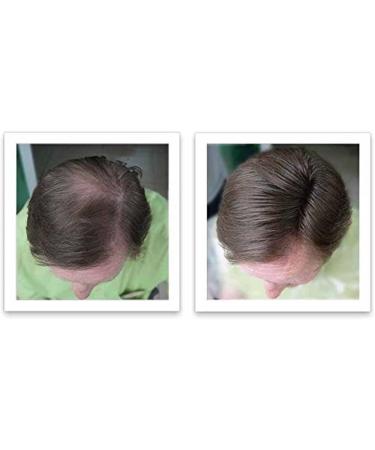 Caboki Hair Loss Concealer Hair Building Fiber 25g (Black) - Buy Online on GoSupps.com