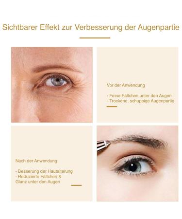 Elegista Eye Pads Masks - 50 Pairs for Dark Circles | Hyaluron & Vitamin E Anti-Aging Gel Eye Patches - Buy Online on GoSupps.com