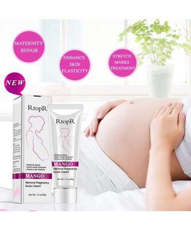 Mango Stretch Marks & Scar Cream (40g) | Pregnancy & Obesity Scar Removal - Wrinkle Reduction & Moisturizing - Buy Online on GoSupps.com