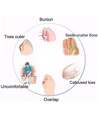 Comfortable Women's Bunion Sandals | Toe Separation & Arch Support | Roman Shoes 5.5 Black - Shop Internationally - Buy Online on GoSupps.com