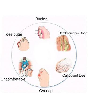 Bunion Corrector Sandals for Women - Pain Relief for Hallux Valgus & Big Toes - Comfortable Foot Correction (Black Size 9 - Buy Online on GoSupps.com