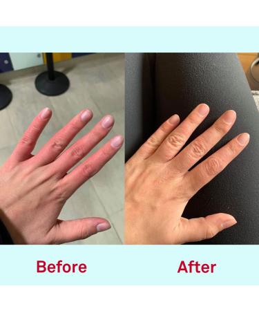 Nursem Hand Care Set | Fast-Absorbing Healing Hand Cream for Extra Dry Hands (Odorless) - International Shipping Available - Buy Online on GoSupps.com