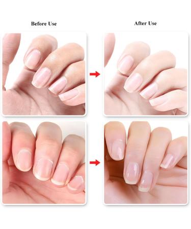 Nail Cuticle Oil for Nail Care - Peach Cuticle Oil with Organic Vitamin E & B Cuticle Oil for Nails Nail Oil Soothe Moisturize with Dropper Design to Prevent Nail Cracking and Dry - Buy Online on GoSupps.com