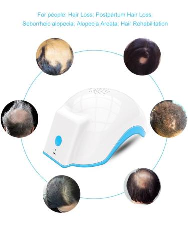 Anti Hair Loss Laser Therapy Helmet for Thinning Hair Treatment | UK - Buy Online on GoSupps.com