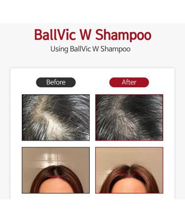 BallVic W Shampoo for Women - Hair Regrowth & Scalp Care | Caffeine & Honey Volumizing Shampoo | PH 5.5 | 8.1 Oz | International Shipping - Buy Online on GoSupps.com